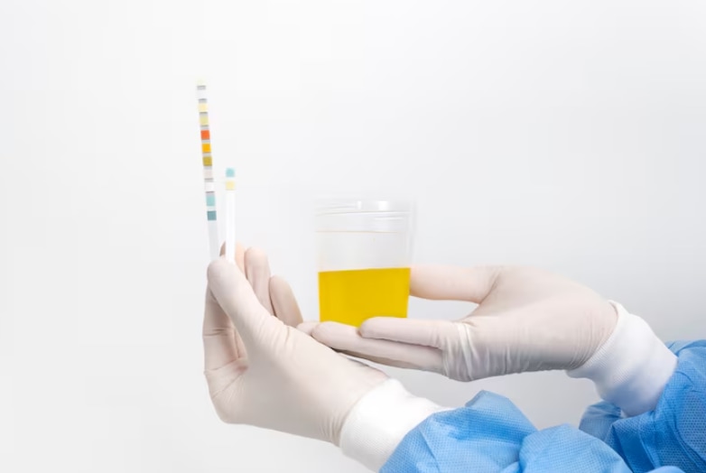 Different Shades Of Urine Does White Urine Means You Are Suffering From Diabetes What The Color Of Your Pee mean