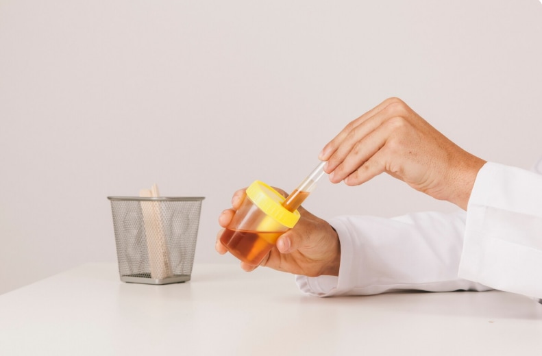 Different Shades Of Urine Does White Urine Means You Are Suffering From Diabetes What The Color Of Your Pee mean