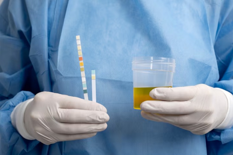 Different Shades Of Urine Does White Urine Means You Are Suffering From Diabetes What The Color Of Your Pee mean