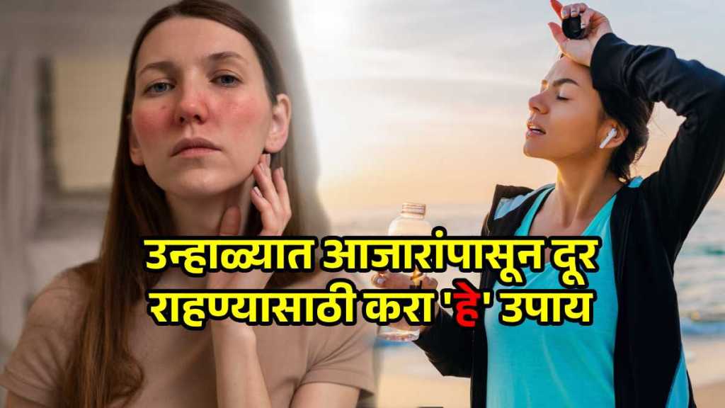 Summer diseases and how to avoid them Summer diseases and how to avoid them