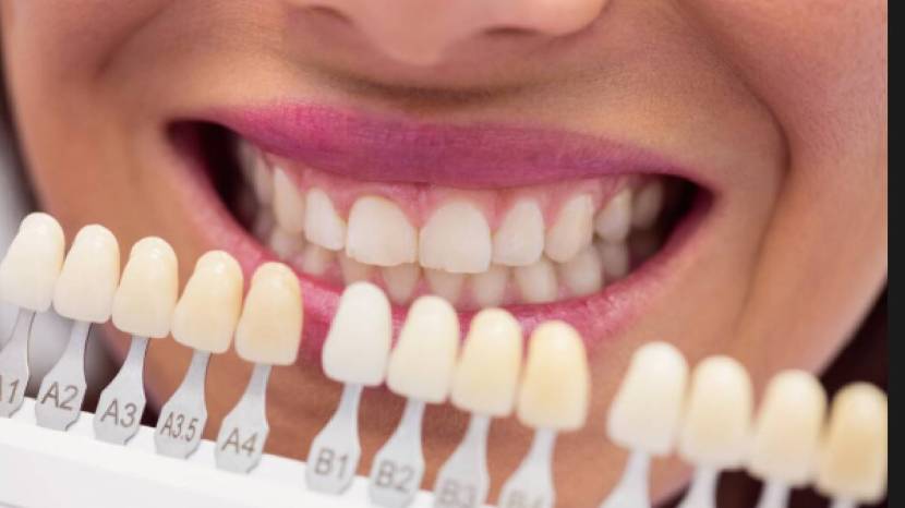 Yellow teeth to white naturally 