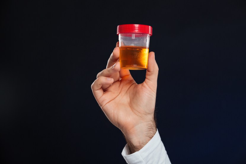 Different Shades Of Urine Does White Urine Means You Are Suffering From Diabetes What The Color Of Your Pee mean