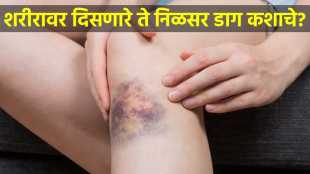 hemophilia complications early detection