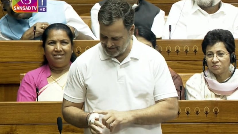 rahul-gandhi-injured-hand