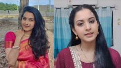 ४ महिने झाले, नाक अन् कपाळावरची पट्टी तशीच…; ‘झी मराठी’च्या नायिकेला दुखापत; अभिनेत्री सांगते, “डॉक्टर म्हणाले…”