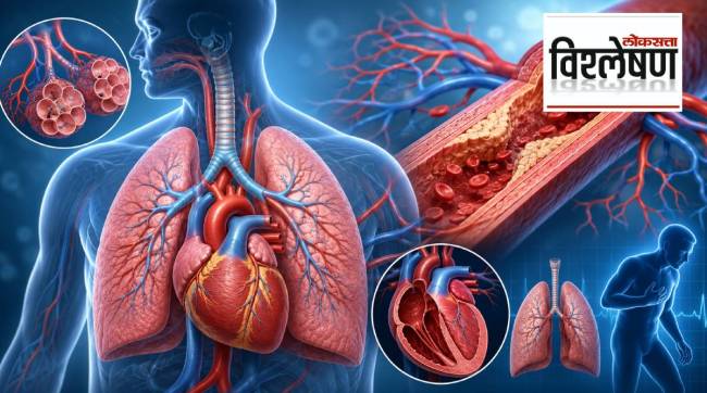 Causes of Pulmonary Hypertension