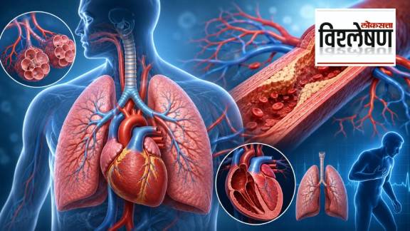 Causes of Pulmonary Hypertension