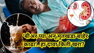 Drinking beer helps remove kidney stones What doctors say about this viral trend