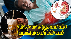 बीअर पिऊन मुतखडा जाईल? व्हायरल ट्रेंड कसा ठरू शकतो धोकादायक? डॉक्टरांनी सांगितलं सत्य