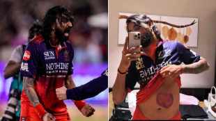 Krunal Pandya shares photo of bruised stomach after heroic knock vs MI IPL 2026