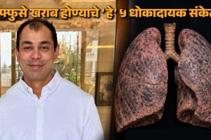 Doctor explaining dangers of lung infection and blood clot after Prateek Yadav death case