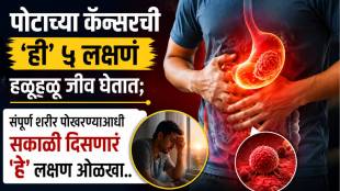 What are the early signs of stomach cancer know what an oncologist says