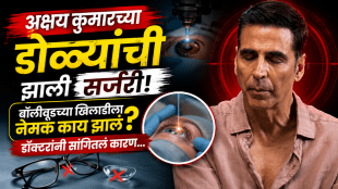 Akshay Kumar Eye Surgery vision correction surgery what is vision correction surgery to remove specs glasses