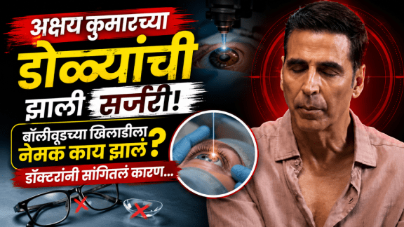 Akshay Kumar Eye Surgery vision correction surgery what is vision correction surgery to remove specs glasses