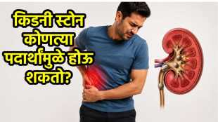 foods that cause kidney stones