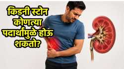 किडनी स्टोन कोणत्या पदार्थांमुळे होऊ शकतो? डॉक्टरांनी दिली माहिती