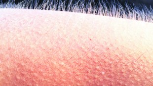 Why Do We Get Goosebumps