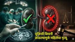 उजवी किडनी काढण्याऐवजी डावी किडनी काढली, महिलेचा झाला मृत्यू; ग्राहक न्यायालयाचा दणका, ‘इतकी’ नुकसान भरपाई देण्याचे आदेश