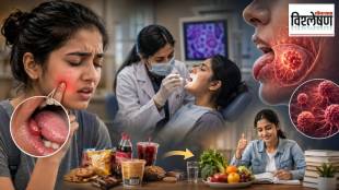 mouth-cancer-symptoms-tongue-cancer-youth-awareness