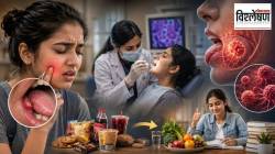 तोंडातील फोडाकडे दुर्लक्ष केले अन् निघाला कॅन्सर; निर्व्यसनी तरुणीला कर्करोग कशामुळे झाला?