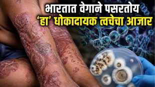 trichophyton indotineae fungal infection