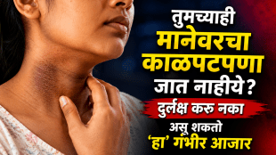 Diabetes Symptoms early signs of diabetes on skin Dark neck small skin tags what are the skin problems with diabetes