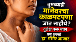 तुमच्याही मानेवरचा काळपटपणा जात नाहीये? दुर्लक्ष करु नका असू शकतो ‘हा’ गंभीर आजार, डॉक्टरांनी सांगितला धोका