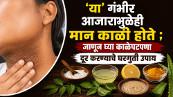 ‘या’ गंभीर आजारामुळेही मान काळी होते ; जाणून घ्या काळपटपणा दूर करण्याचे घरगुती उपाय