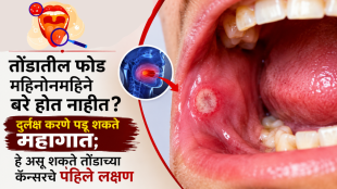 Mouth Cancer Symptoms