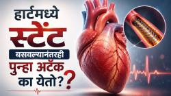 Heart Attack: ५ वर्षांत ४ हार्ट अटॅक आणि ८ स्टेंट्स; तरीही ‘हा’ रुग्ण वाचला कसा? डॉक्टरांनी नेमकं काय सांगितलं?