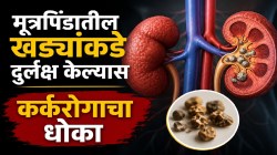 किडनी स्टोनकडे दुर्लक्ष केल्यास कँन्सरचा धोका; ‘ही’ छोटीशी हलगर्जी ठरू शकते जीवघेणी, डॉक्टरांनी दिली महत्त्वाची आरोग्य माहिती