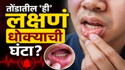 तोंडातील ‘ही’ समस्या साधी समजू नका; दुर्लक्ष केल्यास महागात पडू शकतं, तोंडाच्या कर्करोगाची असू शकतात ‘ही’ सुरुवातीची लक्षणं