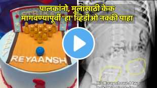 child swallowed metal wire from cake video