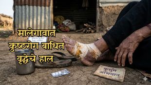 Kusum Abhiyan Maharashtra health department ground reality check | Malegaon leprosy patient negligence case BJP bandukaka bachhav protest | कुसुम अभियान महाराष्ट्र कुष्ठरोग निर्मूलन वास्तव | मालेगाव कुष्ठरुग्ण हलगर्जीपणा प्राथमिक आरोग्य केंद्र भाजप आंदोलन