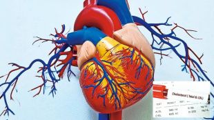 Cholesterol control diet tips and fibrous foods layout | Good HDL bad LDL difference lipid profile test chart | कोलेस्टेरॉल नियंत्रण आहार टिप्स | चांगले आणि वाईट कोलेस्टेरॉल फरक हृदय आरोग्य