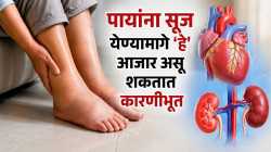 Swollen Feet : पायांवर वारंवार सूज येतेय? दुर्लक्ष करू नका, असू शकते किडनी, हृदयाच्या गंभीर आजारांचे संकेत!