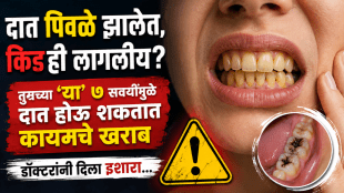 yellow teeth cavity reason daily habits that damage your teeth dentist advice