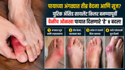 अंथरुणातून पाय खाली ठेवताना टाचांमध्ये होते तीव्र वेदना? युरिक ॲसिड वाढल्याचे पायात दिसतात ‘हे’ ४ गंभीर संकेत, नाहीतर…