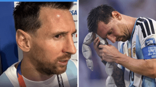 Lionel Messi forehead injury during Argentina vs Cape Verde match | Argentina vs Cape Verde World Cup 2026 Lionel Messi record | लिओनेल मेस्सी अर्जेंटिना विरुद्ध केप व्हर्डे सामना दुखापत | फिफा विश्वचषक २०२६ लिओनेल मेस्सी मॅराडोना रेकॉर्ड
