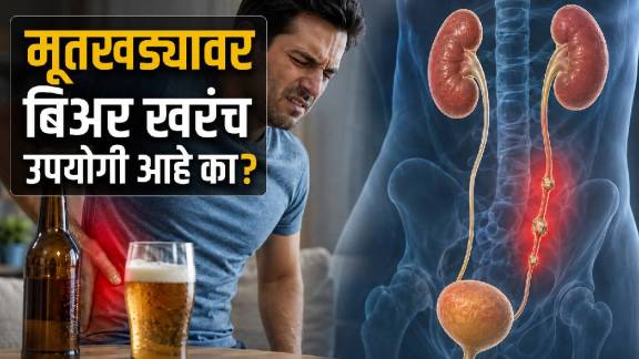 Beer For Kidney Stone Fact Check