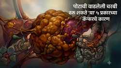 सावधान! पोटाची वाढलेली चरबी ठरू शकते ‘या’ ५ प्रकारच्या कॅन्सरचे कारण; वेळीच व्हा सतर्क अन् सवयींमध्ये करा ‘हे’ बदल