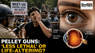 A 19-year-old protester receiving emergency treatment for pellet eye injury after Jantar Mantar NEET protest
