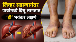 लिव्हर सडल्यानंतर पायांमध्ये दिसू लागतात ‘ही’ भयंकर लक्षणे, चुकूनही करू नका दुर्लक्ष नाहीतर येईल ऑपरेशनची वेळ