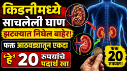 किडनीमध्ये साचलेली घाण झटक्यात निघेल बाहेर; फक्त आठवड्यातून एकदा ‘हे’ २० रुपयांचे पदार्थ खा, परिणाम पाहून थक्क व्हाल