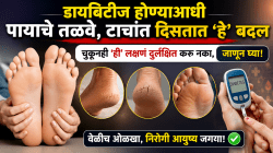 डायबिटीज होण्याआधी पायाचे तळवे, टाचांत दिसतात ‘हे’ बदल; चुकूनही ‘ही’ लक्षणं दुर्लक्षित करु नका, जाणून घ्या