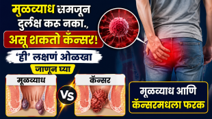 Colon cancer symptoms warning signs piles symptoms health news