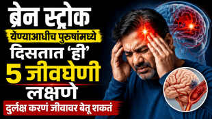 what are the 5 warning signs of stroke in man explains neurologist