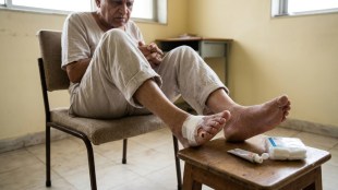 diabetic foot ulcer symptoms india | diabetes complications foot care | lancet study diabetes mortality risk | diabetic neuropathy symptoms prevention