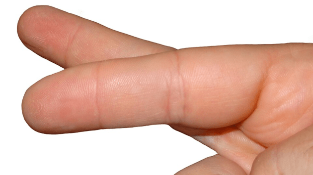 why do we cross our fingers for luck