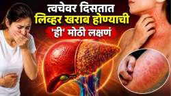 त्वचेवर खाज, लाल चट्टे, मळमळ? लिव्हर खराब होण्याची ‘ही’ लक्षणं वेळीच ओळखा अन्यथा होईल गंभीर आजार!